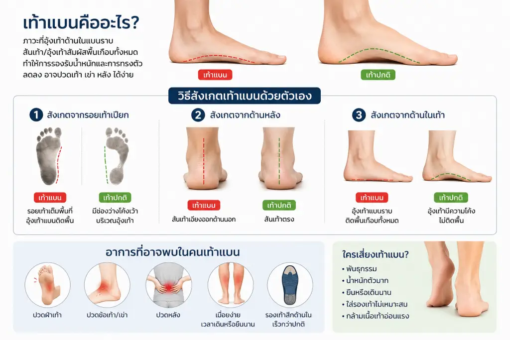 วิธีสังเกตเท้าแบน